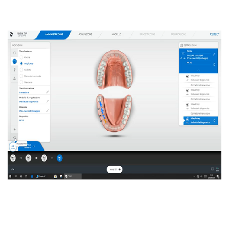 Fase di amministrazione per rialzo occlusale con SW Cerec 5.0.2