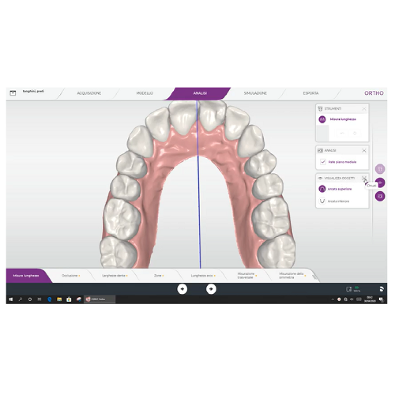 Analisi Modello per Trattamento Ortodontico