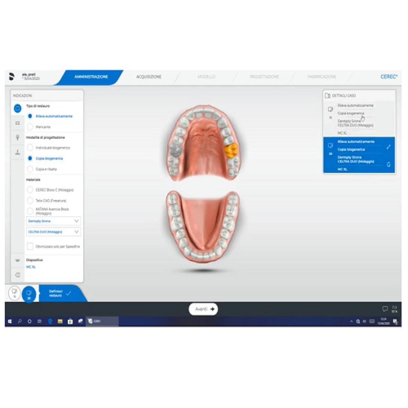 Fase di amministrazione per Biocopia con SW Cerec 5.0.2