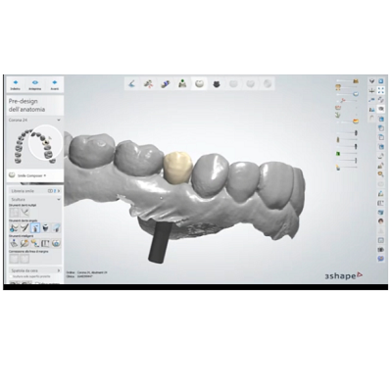 DentalSystem – Design di un pilastro implantare: elemento 2.4