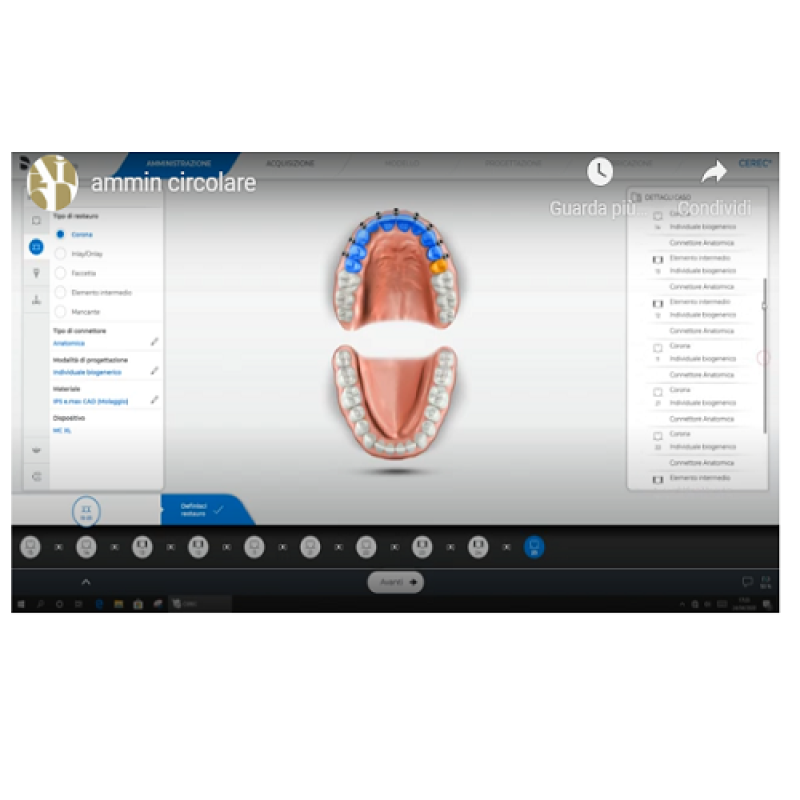 Fase di amministrazione per restauro circolare con SW Cerec 5.0.2