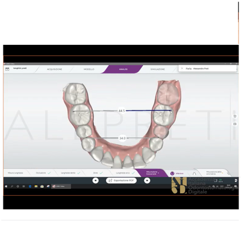 La Progettazione con Cerec Ortho