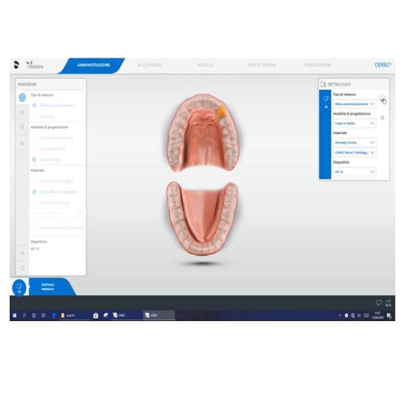 Fase di amministrazione per modalità copia e ribalta con SW Cerec 5.0.2