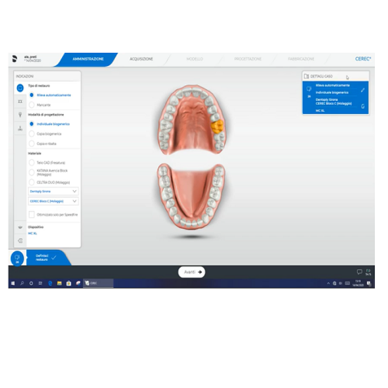 Fase di amministrazione per elemento singolo posteriore con SW Cerec 5.0.2