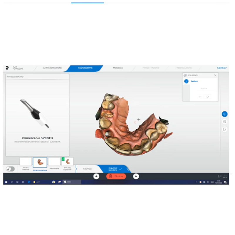 Acquisizione Biocopia con Scanner Intraorale Primescan