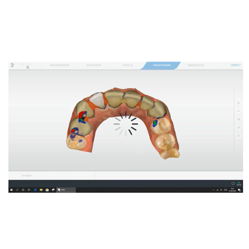 Progettazione di un restauro Ponte Anteriore: 1.4-2.3